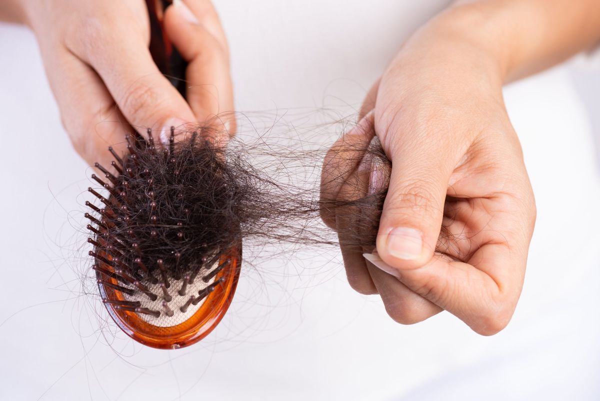 19 Causes of Hair Loss, How to Treat It | Health.com