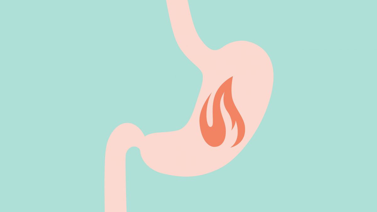 Acid reflux symptoms and lungs