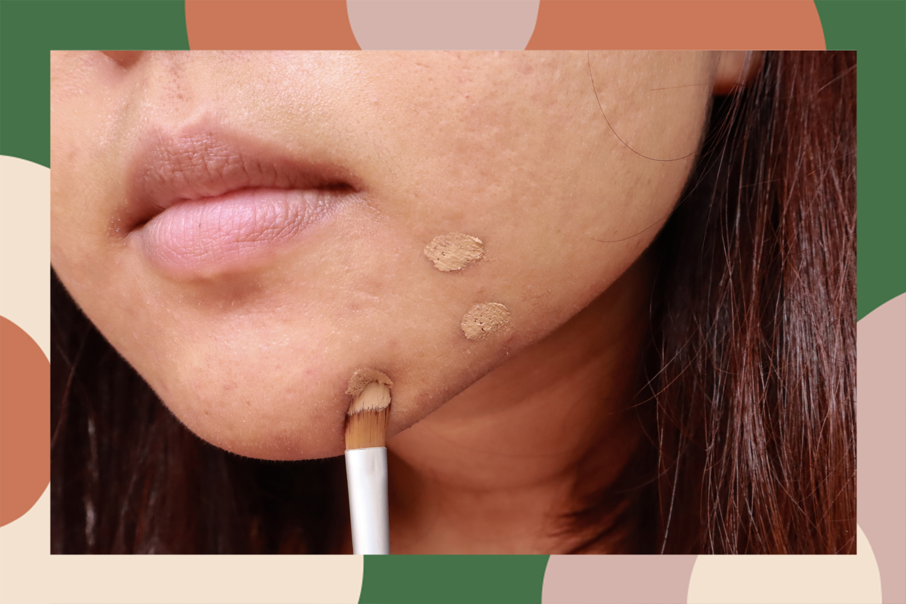 Cover A Pimple And Other Types Of Acne