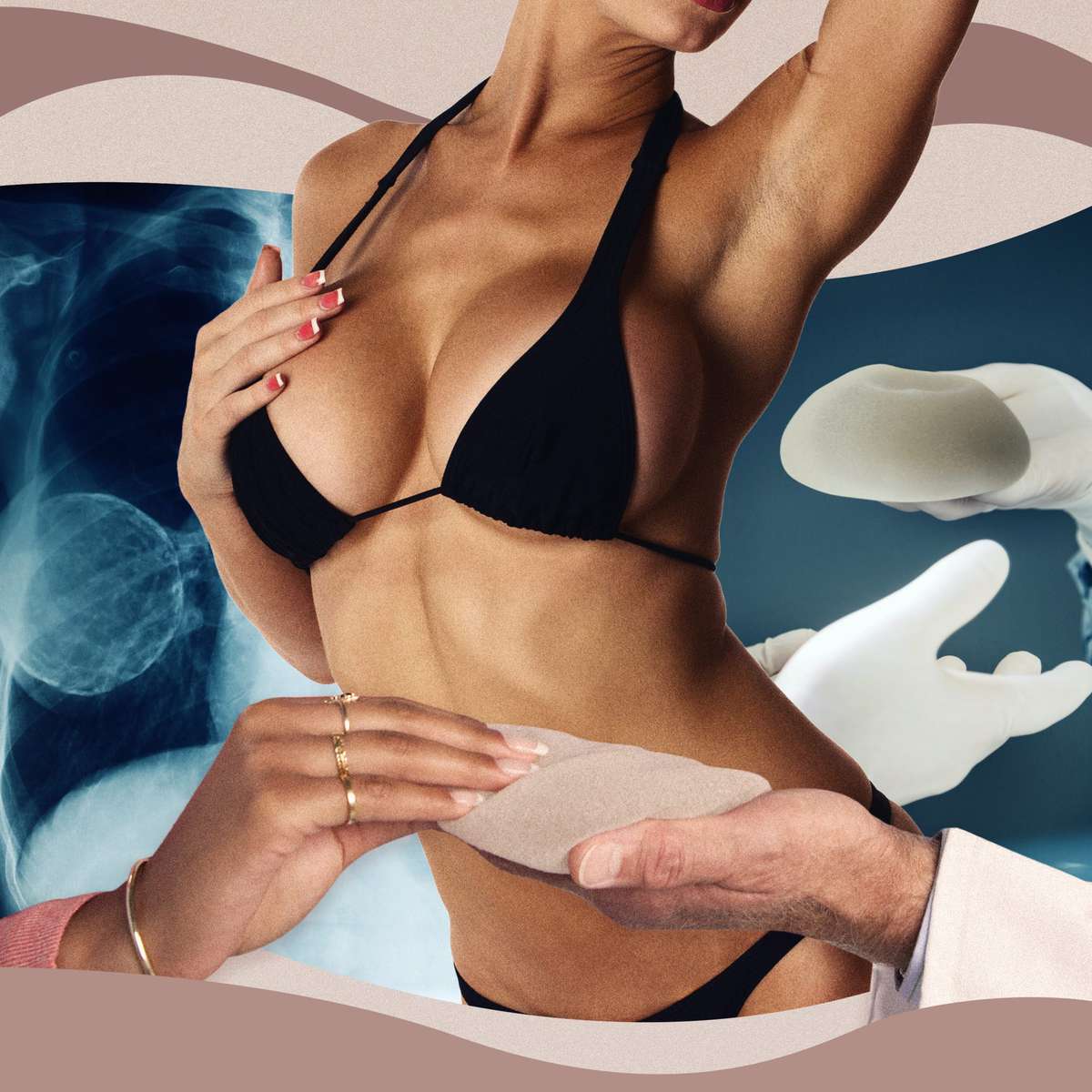 Natural vs fake looking breast implants