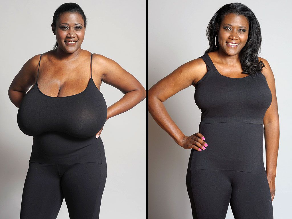 Woman Whose Bra Size Was 36N Gets a 