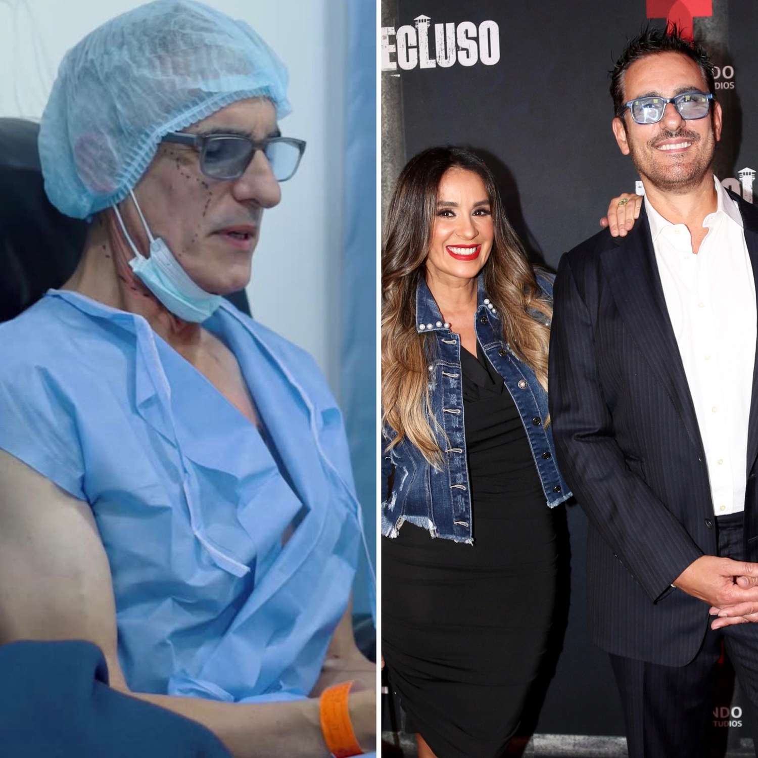 Miguel Varoni inicia su transformación con un cirujano plástico | People en  Español