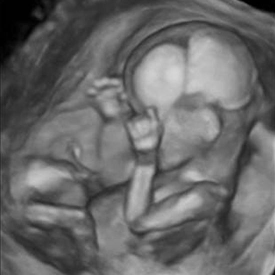 Pictures boy how or ultrasound tell girl to Baby Gender